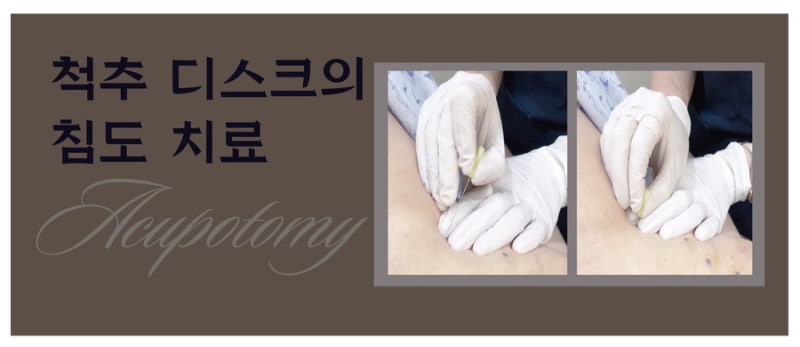 디스크 관련 이미지 6