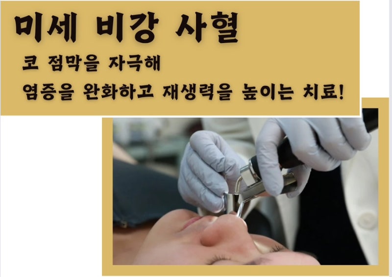 비염 관련 이미지 3