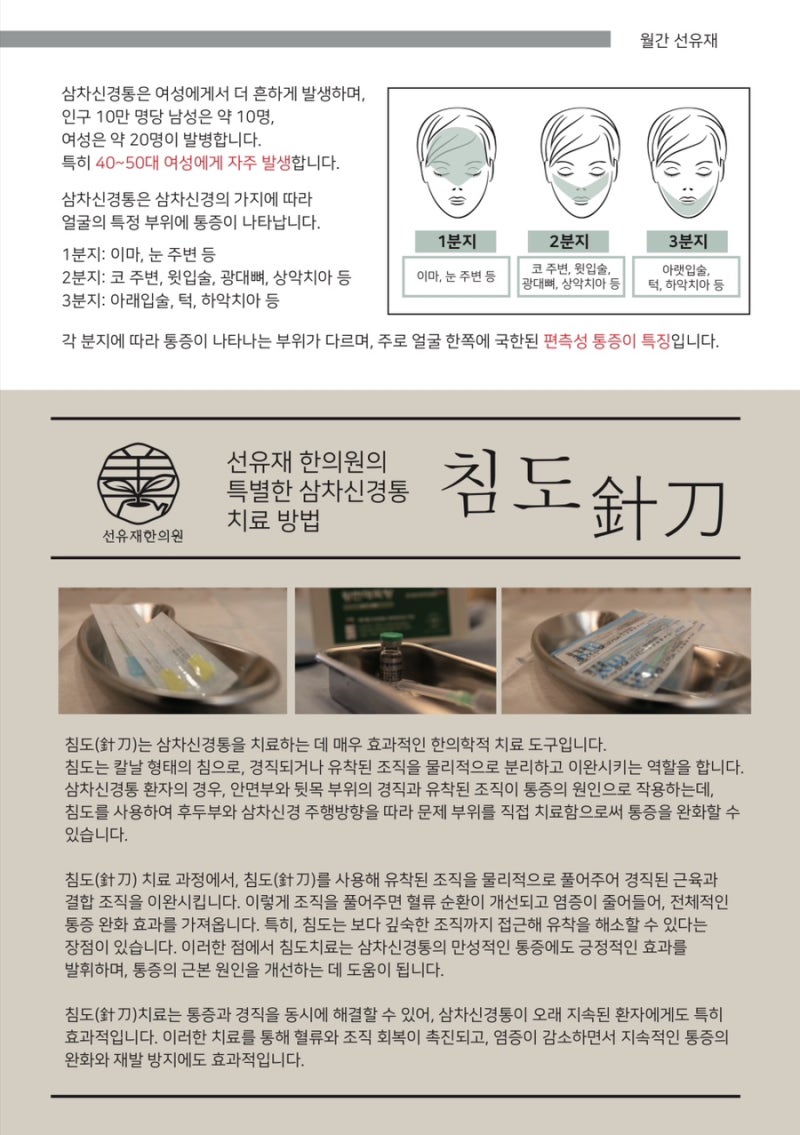 삼차신경통 관련 이미지 13