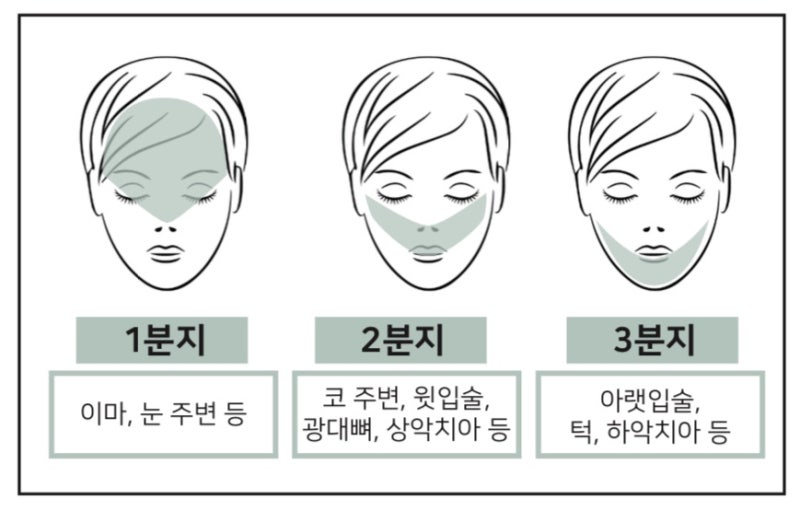 삼차신경통 관련 이미지 8