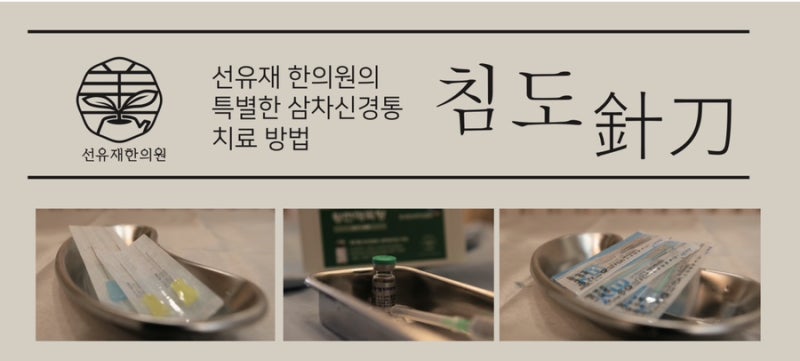 삼차신경통 관련 이미지 9
