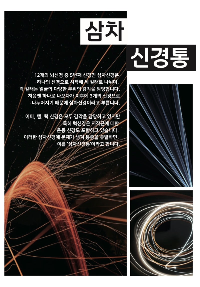 삼차신경통 관련 이미지 10