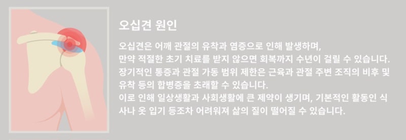 오십견 관련 이미지 4