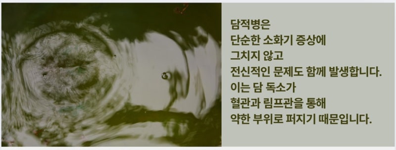 담적 관련 이미지 5