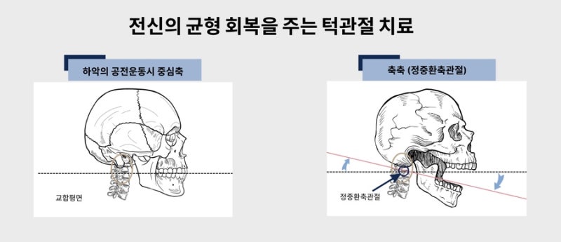 수지구 한의원 - [선유재한의원] 턱 관련 이미지 4