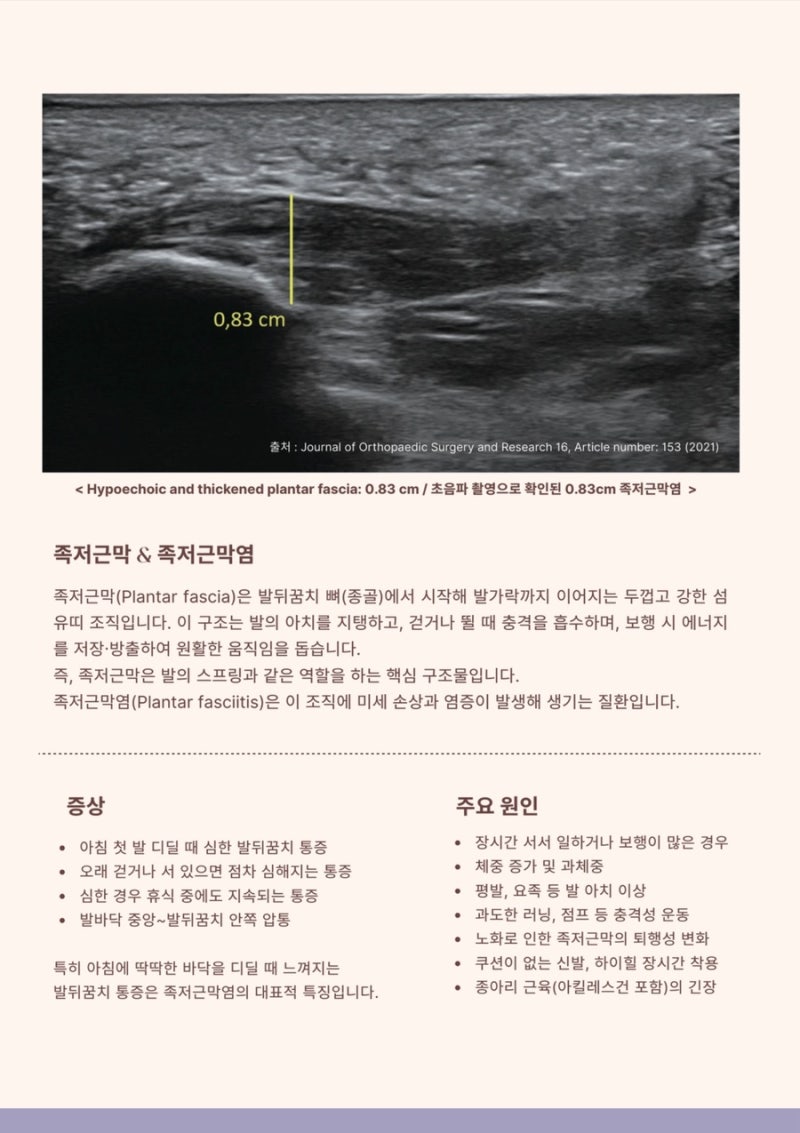 족저근막염 관련 이미지 5