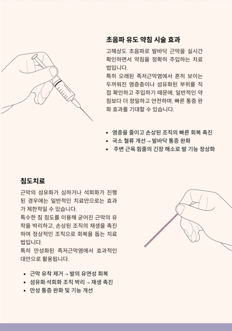 족저근막염 관련 이미지 7
