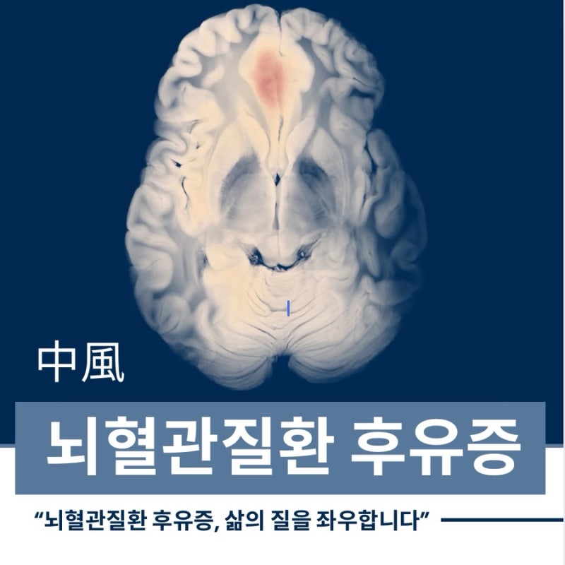 침도 관련 이미지 4