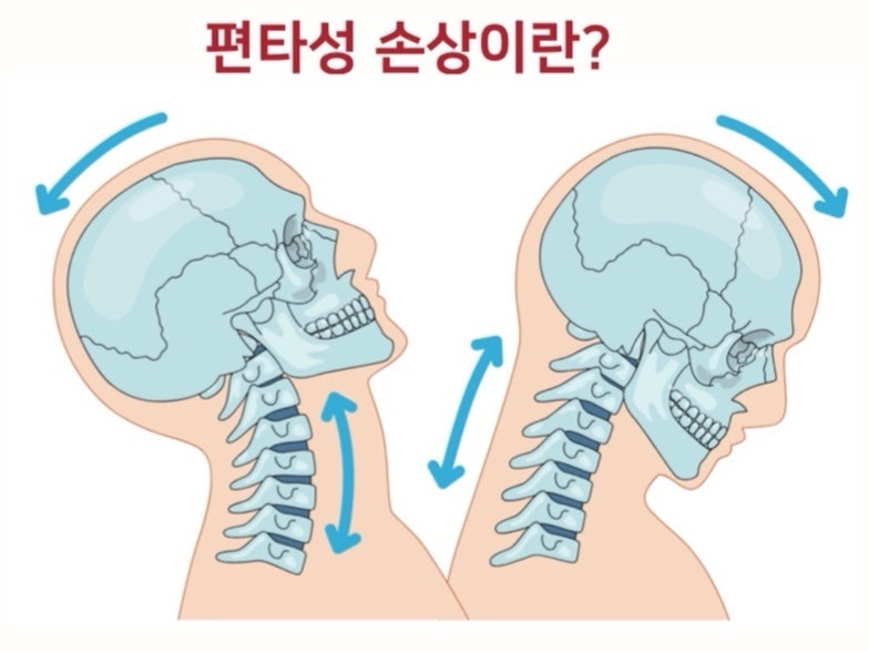 교통사고 관련 이미지 4