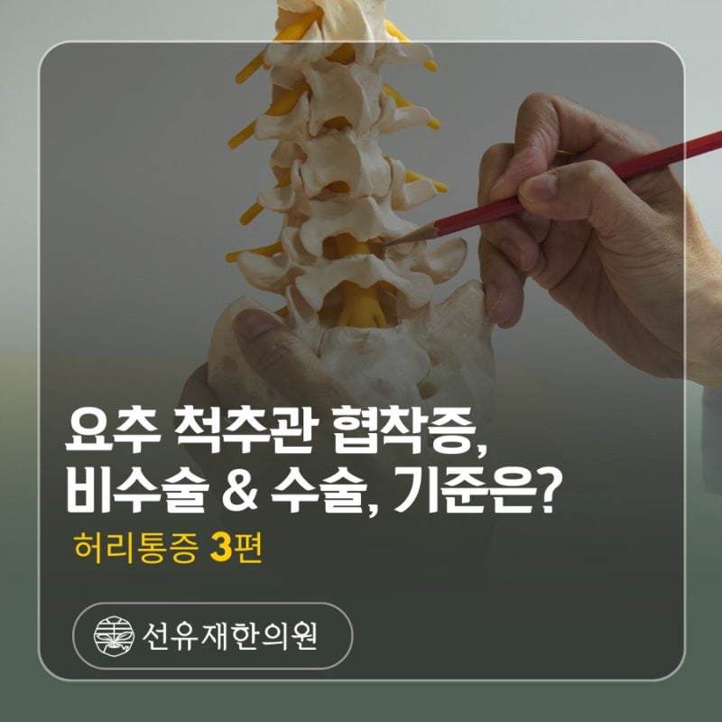 척추관협착증 관련 이미지 2