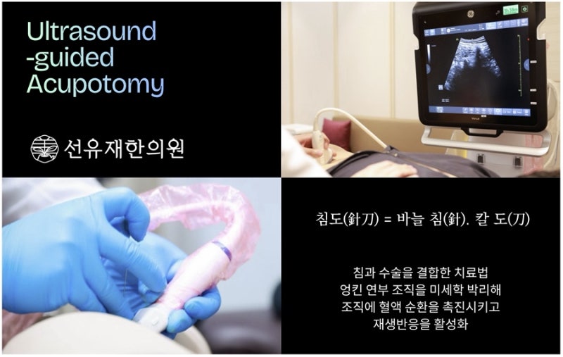 척추관협착증 관련 이미지 4
