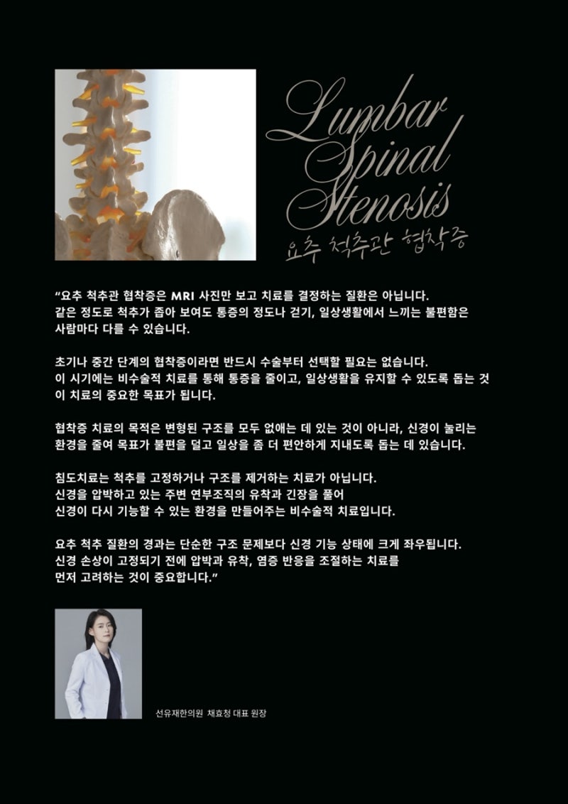 척추관협착증 관련 이미지 6