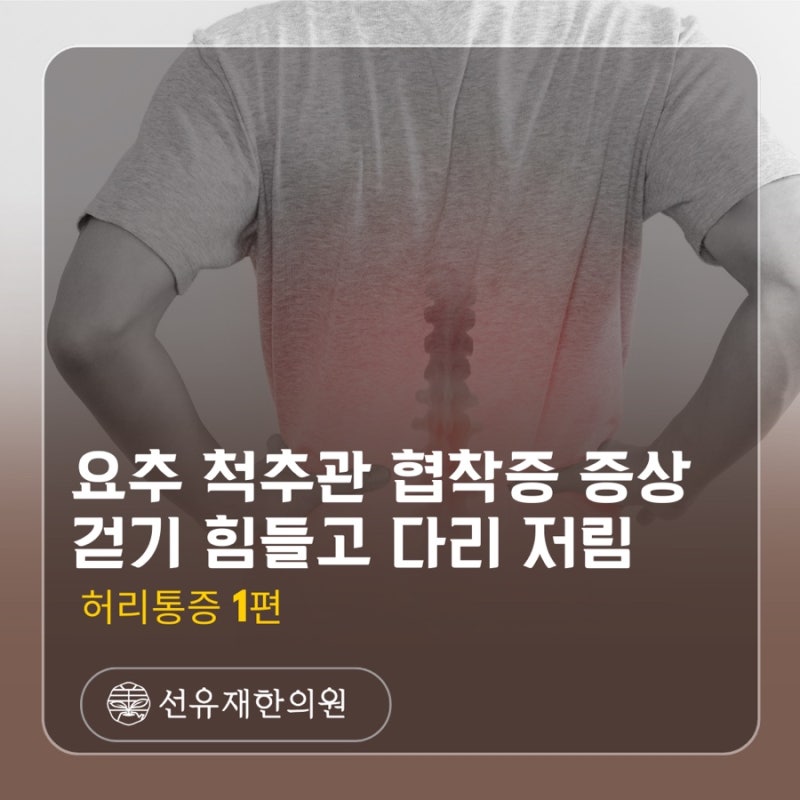척추관협착증 관련 이미지 2