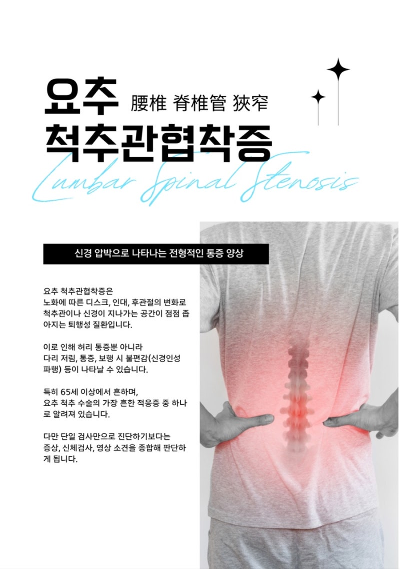 척추관협착증 관련 이미지 5
