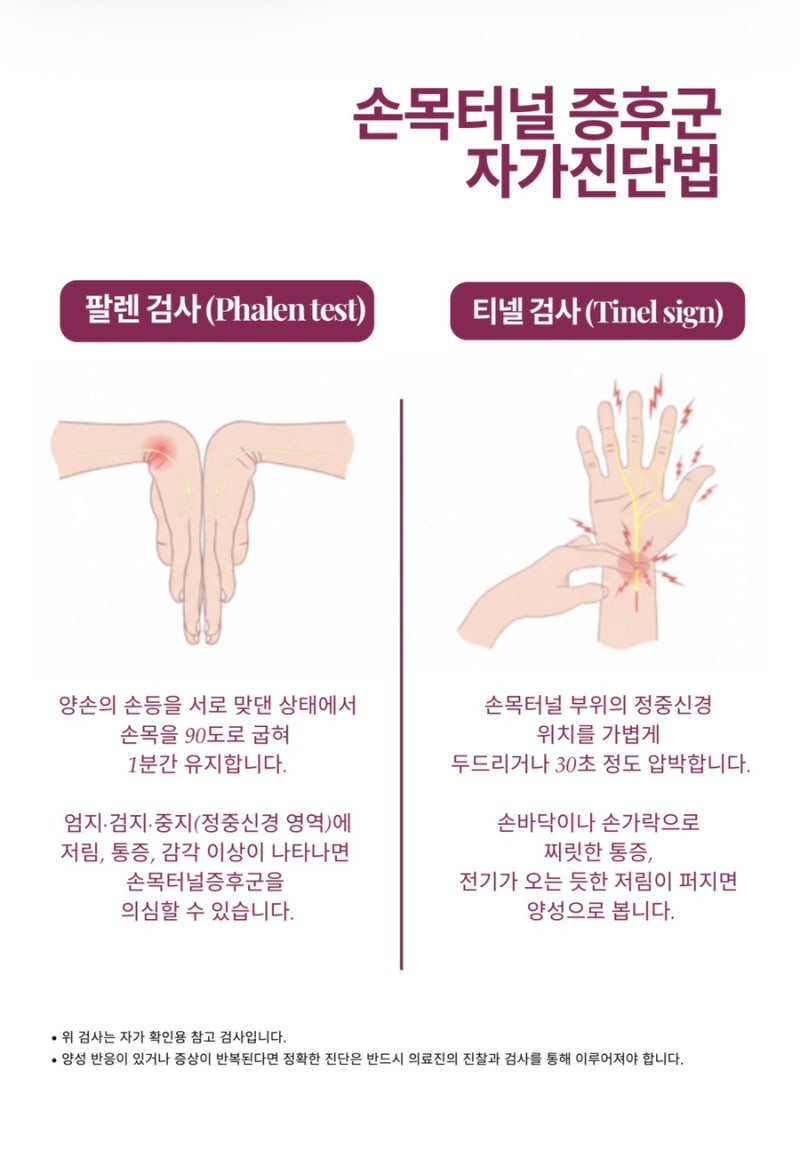 수근관 관련 이미지 11