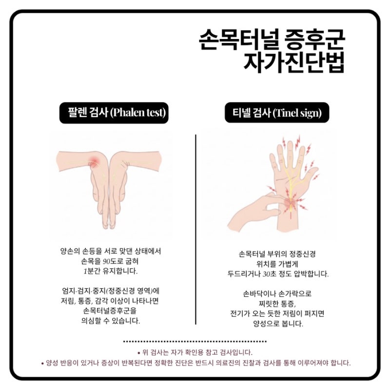 수근관 관련 이미지 4