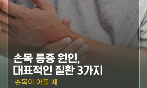 수근관 관련 이미지 5