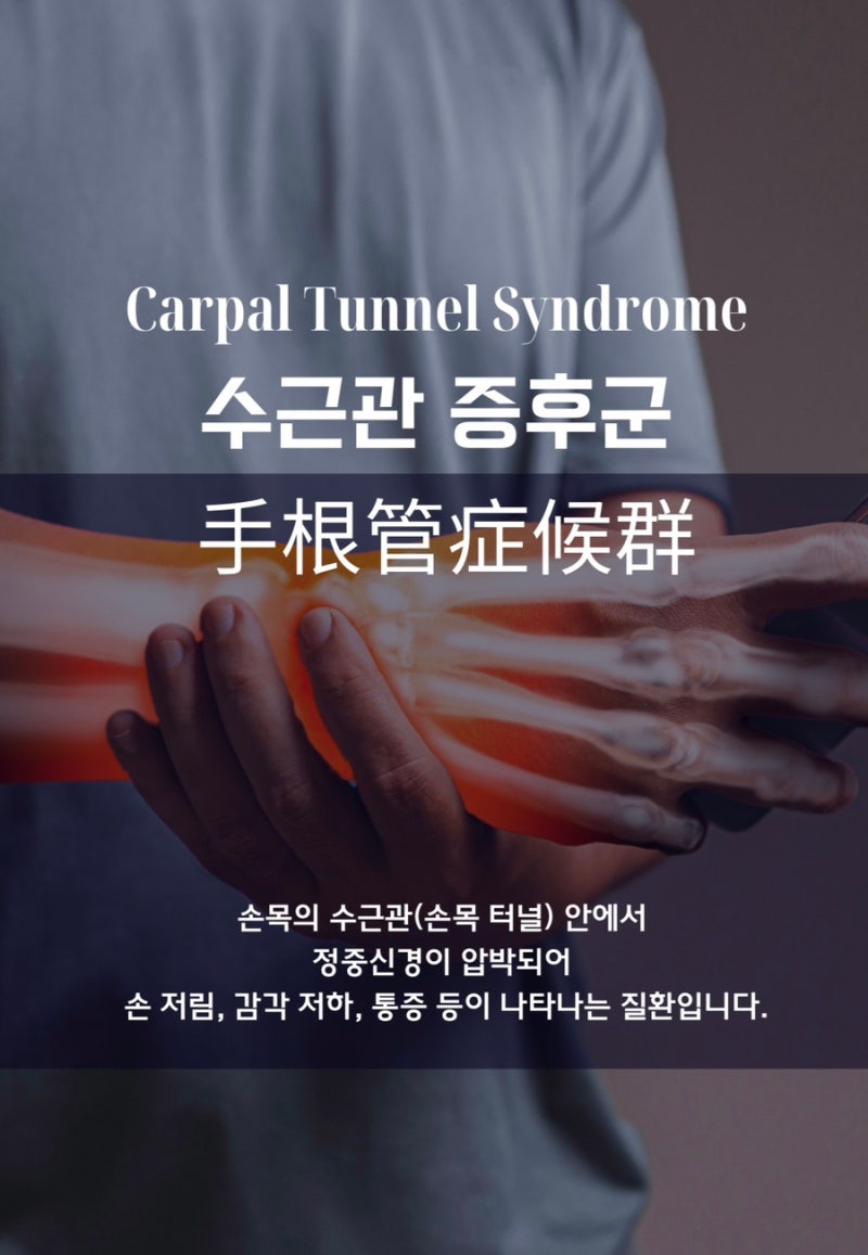 수근관 관련 이미지 6