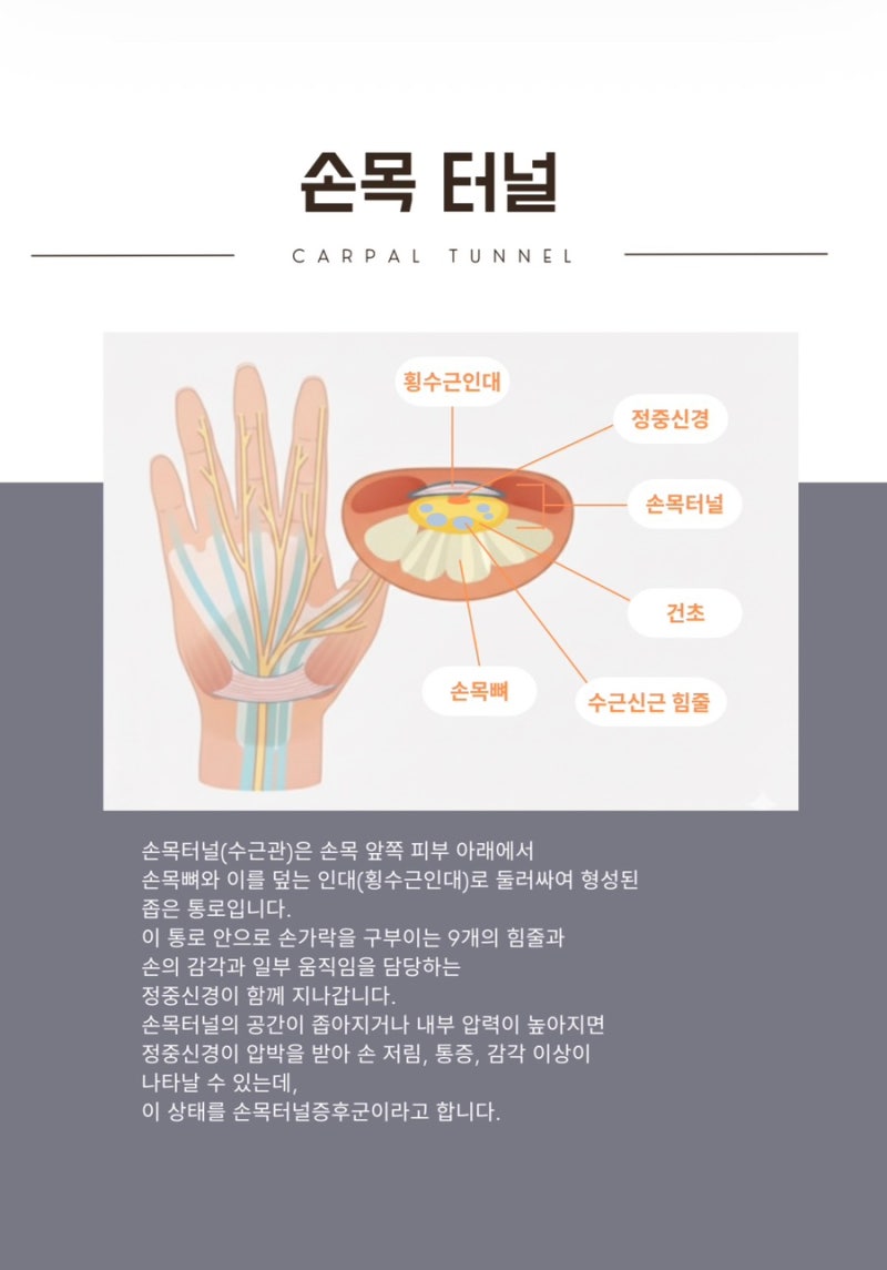 수근관 관련 이미지 7