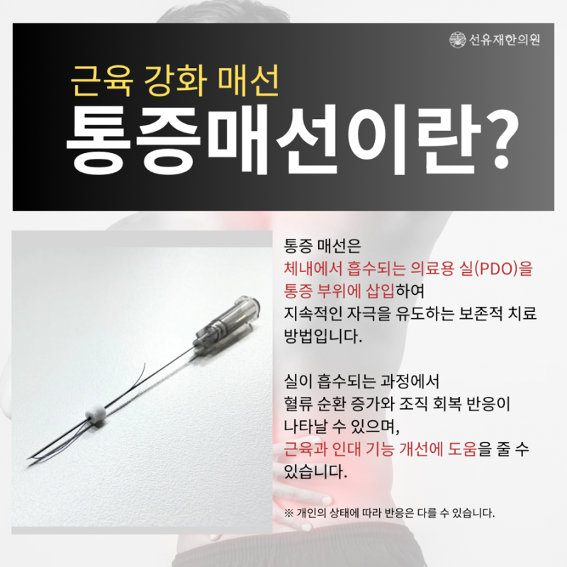 만성통증 관련 이미지 3