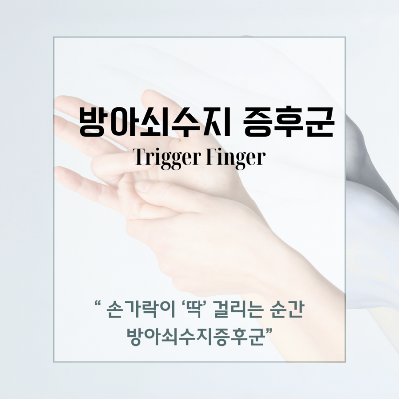 방아쇠수지 관련 이미지 3