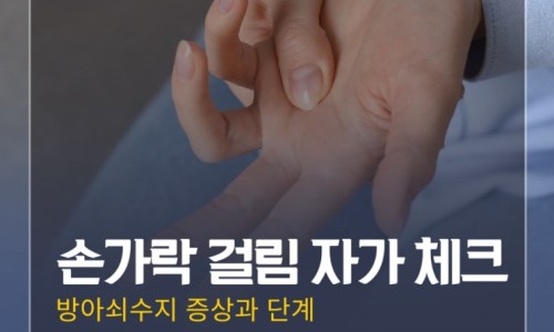 방아쇠수지 관련 이미지 6