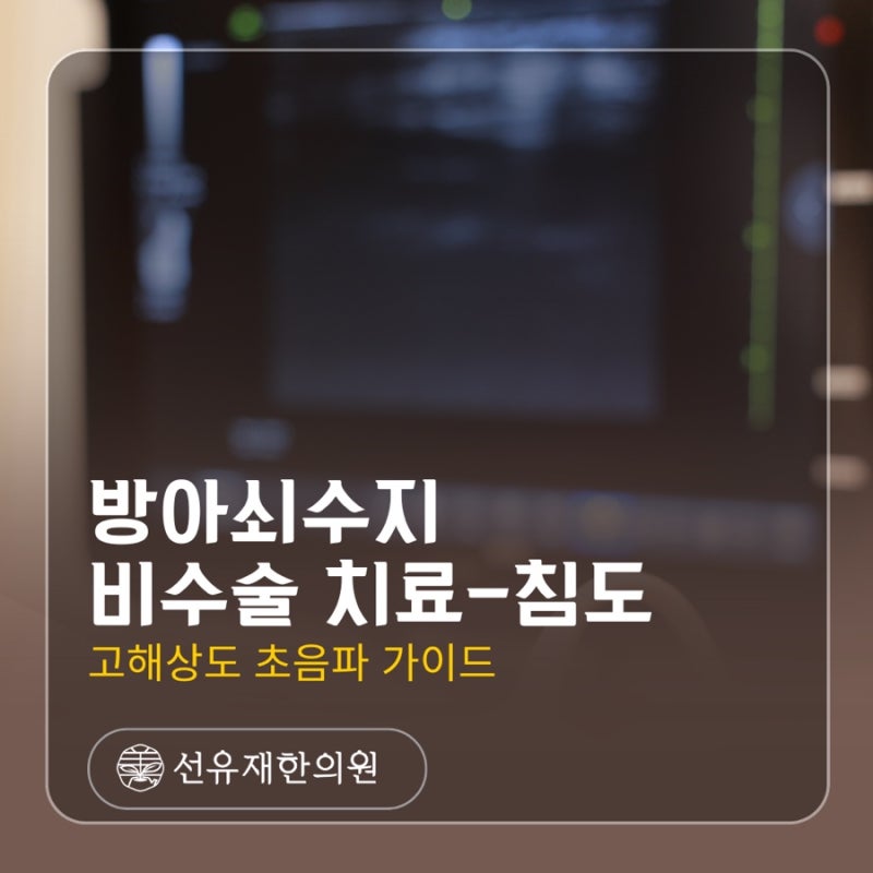 손가락이 ‘딸깍’ 걸린다면? 방아쇠수지 비수술 침도 치료- 수지구 선유재한의원