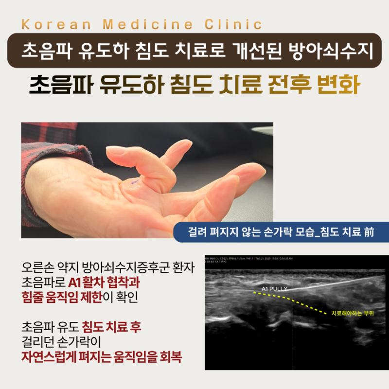 침도 관련 이미지 4