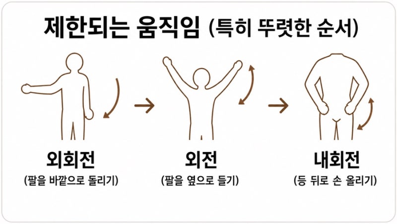 오십견 관련 이미지 5