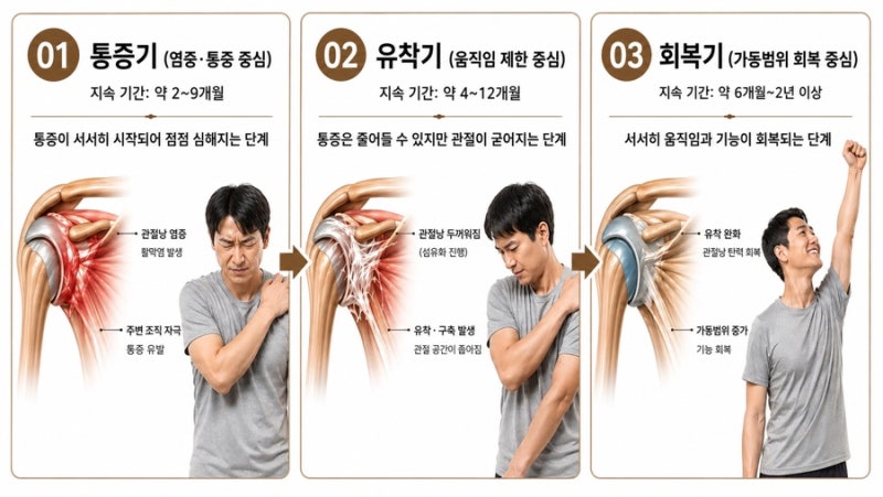 오십견 관련 이미지 7