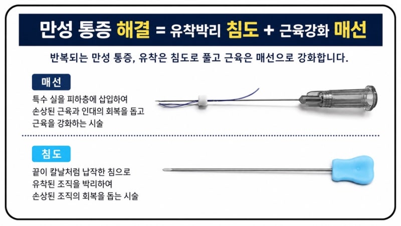 골프엘보 관련 이미지 5