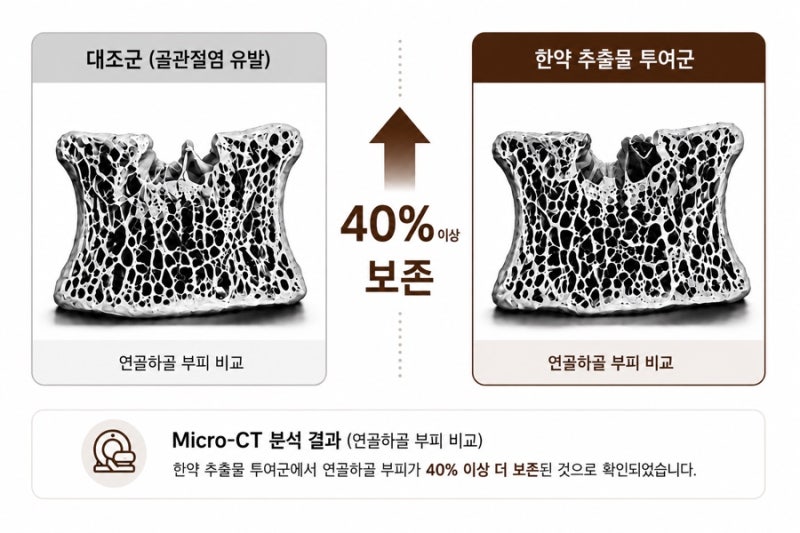 허리디스크 관련 이미지 5