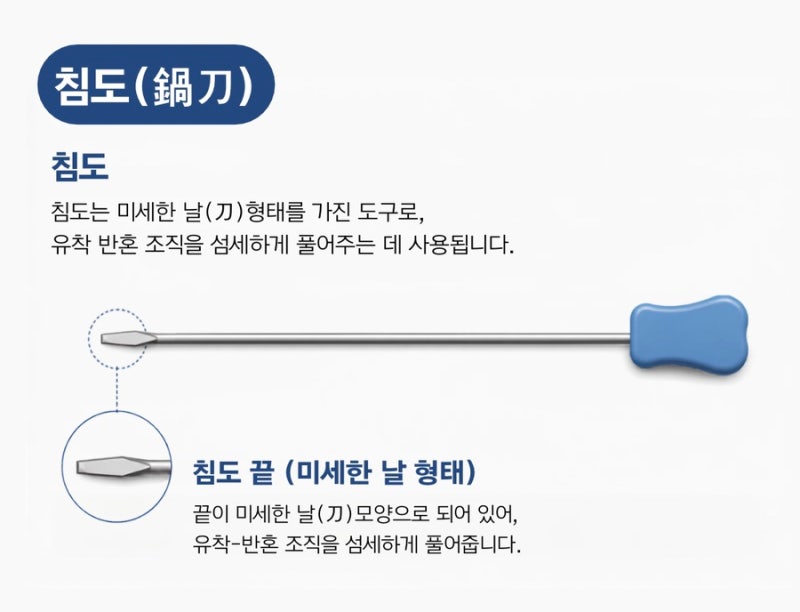 침도 치료 관련 이미지 4
