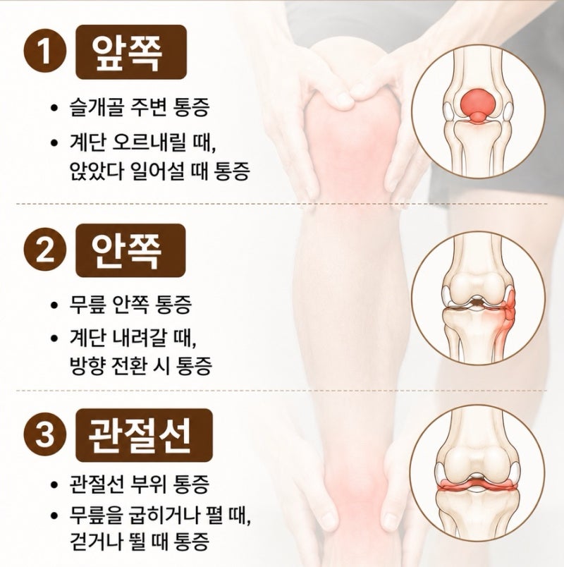 침도 치료 관련 이미지 3