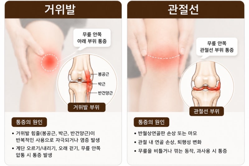 침도 치료 관련 이미지 6