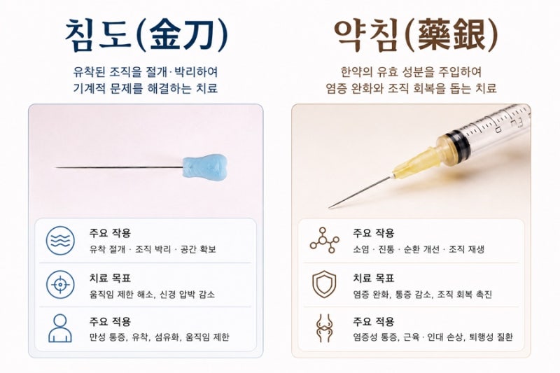 침도 치료 관련 이미지 3