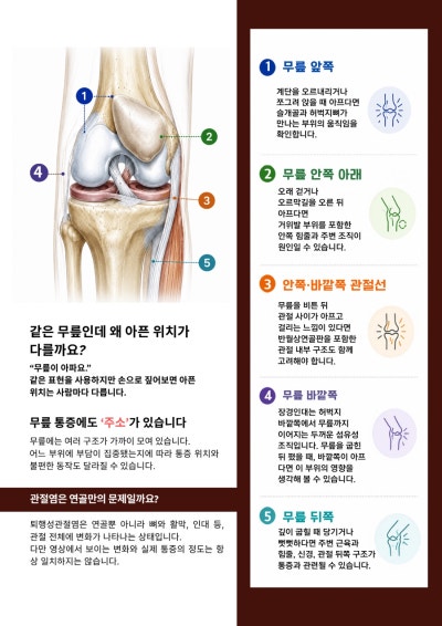 침도 치료 관련 이미지 14