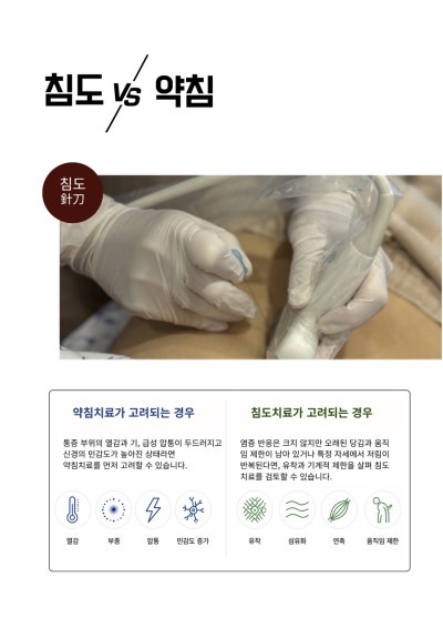 침도 치료 관련 이미지 6