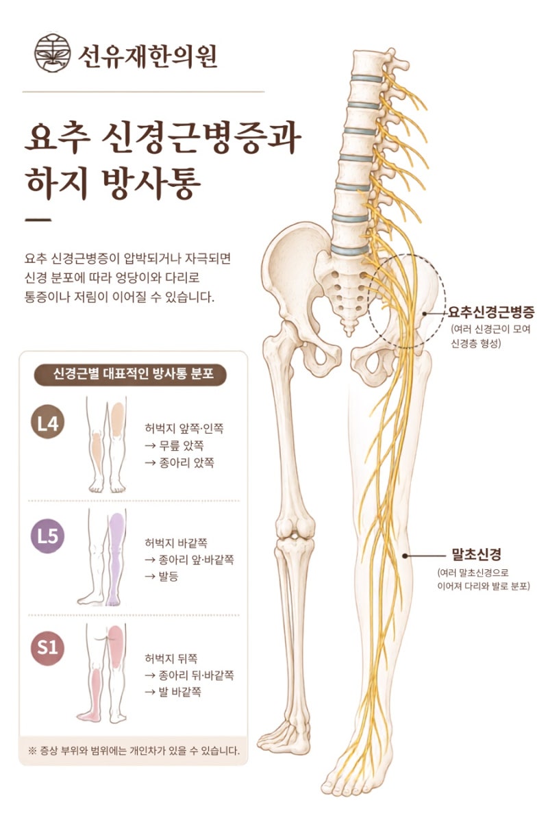 침도 치료 관련 이미지 3